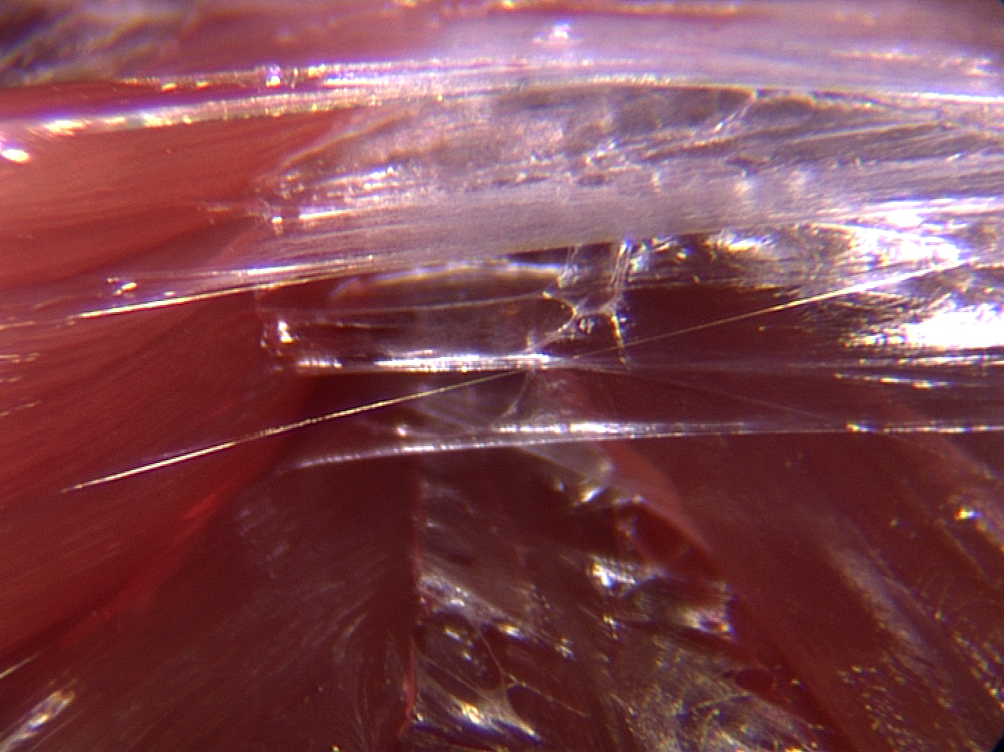 Therapeutic Insight: The Myofascial Release Perspective—A Sea of Information, MASSAGE Magazine